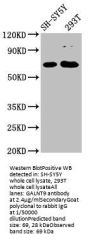 KRT76 Antibody