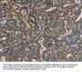 PPARGC1B Antibody