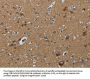 PPARGC1B Antibody