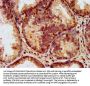 LAMA2 Antibody