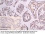 LANCL1 Antibody