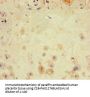 LATS1 Antibody