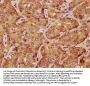 LATS1 Antibody