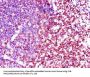 LCK Antibody