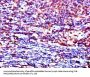 LCK Antibody