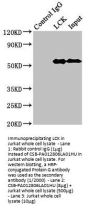 LCK Antibody