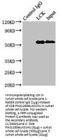 LCK Antibody