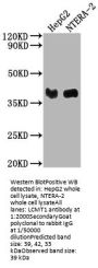 LCMT1 Antibody