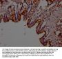 Lcn2 Antibody