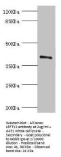 LEFTY2 Antibody