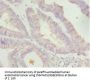 LEFTY2 Antibody