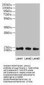 LGALS1 Antibody