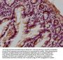LGALS4 Antibody