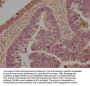 LILRB5 Antibody