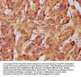 LIMD2 Antibody