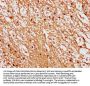 LIMD2 Antibody