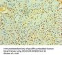 LIMK2 Antibody