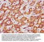 LIPC Antibody