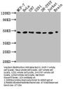 LOX Antibody