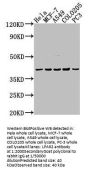 LPAR2 Antibody