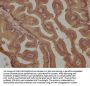LPAR2 Antibody