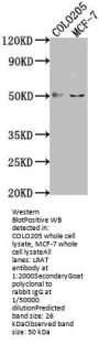 LRAT Antibody