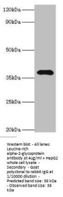 Rabbit anti-human Leucine-rich alpha-2-glycoprotein polyclonal Antibody(LRG1)