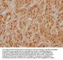 LRP1 Antibody