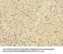 LRP4 Antibody