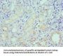 LRP6 Antibody