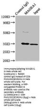 MAGEA1 Antibody