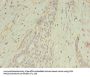 MAGEA10 Antibody