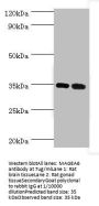 MAGEA6 Antibody