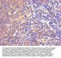 MAOB Antibody