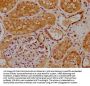 MAP3K2 Antibody