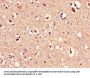 MAPK10 Antibody