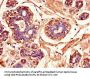 MAPK10 Antibody