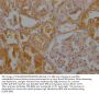 MAS1 Antibody