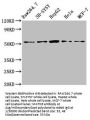 MATN3 Antibody