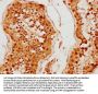 MED26 Antibody