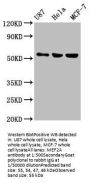 MEF2A Antibody