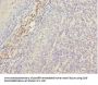 MEOX1 Antibody