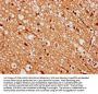 MEX3A Antibody