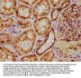 PSMB2 Antibody