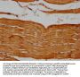 PSMB2 Antibody