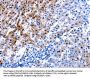 IL2RA Antibody