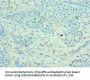 Rabbit anti-human Matrix metalloproteinase-14 polyclonal Antibody(MMP14)