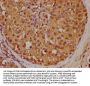 MMP2 Antibody