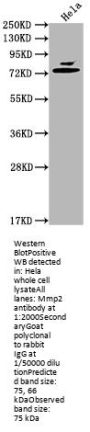 Mmp2 Antibody