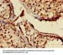 MNAT1 Antibody